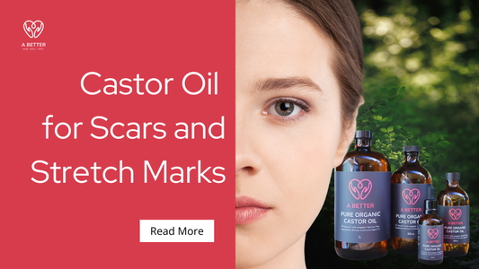 Supporting Your Skin Naturally: How to Use Castor Oil for Scars and Stretch Marks
