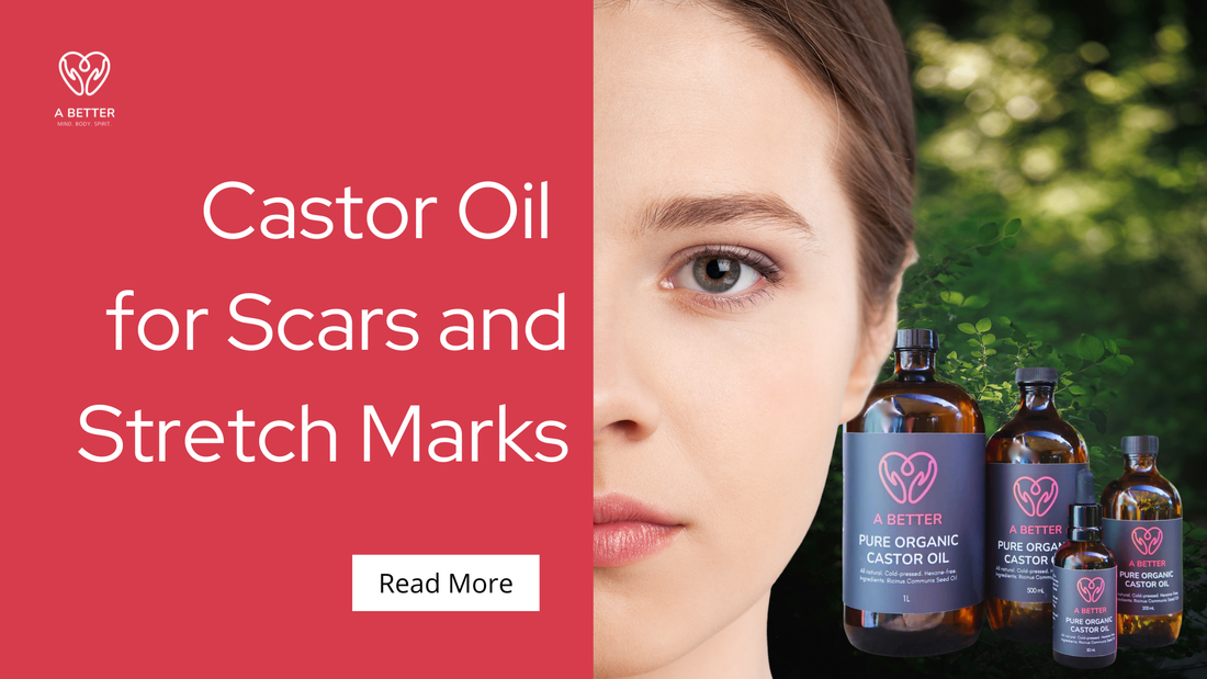 Supporting Your Skin Naturally: How to Use Castor Oil for Scars and Stretch Marks